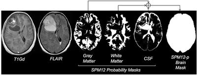 Weakly Supervised Skull Stripping of Magnetic Resonance Imaging of Brain Tumor Patients